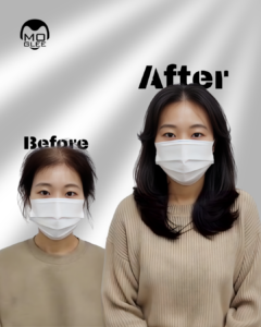 alt="부산맞춤가발"