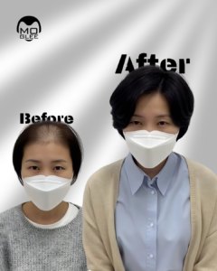 alt="부산맞춤가발"