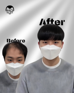 alt="부산맞춤가발"