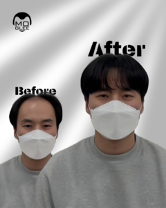 alt="부산맞춤가발"