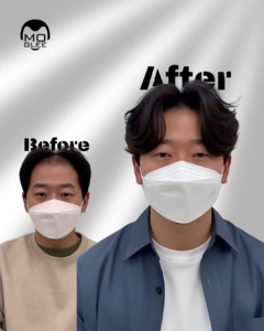 alt="부산맞춤가발"