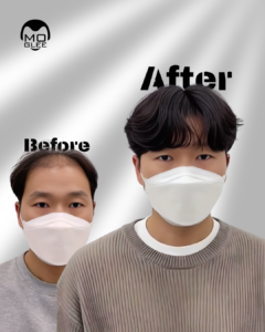 alt="부산맞춤가발"